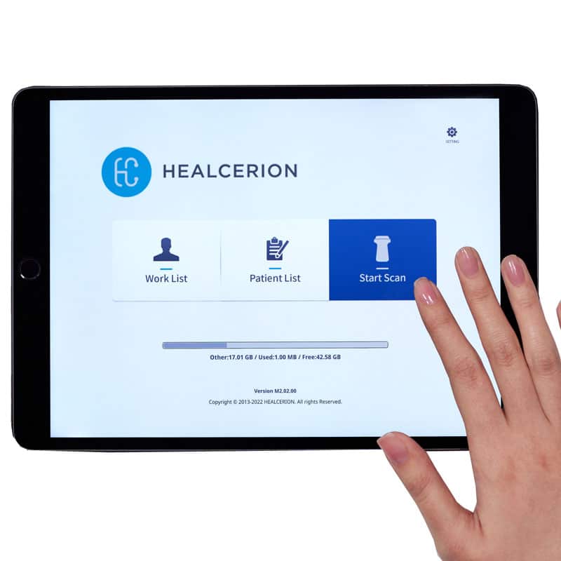 Sonon 500L Ultrasound