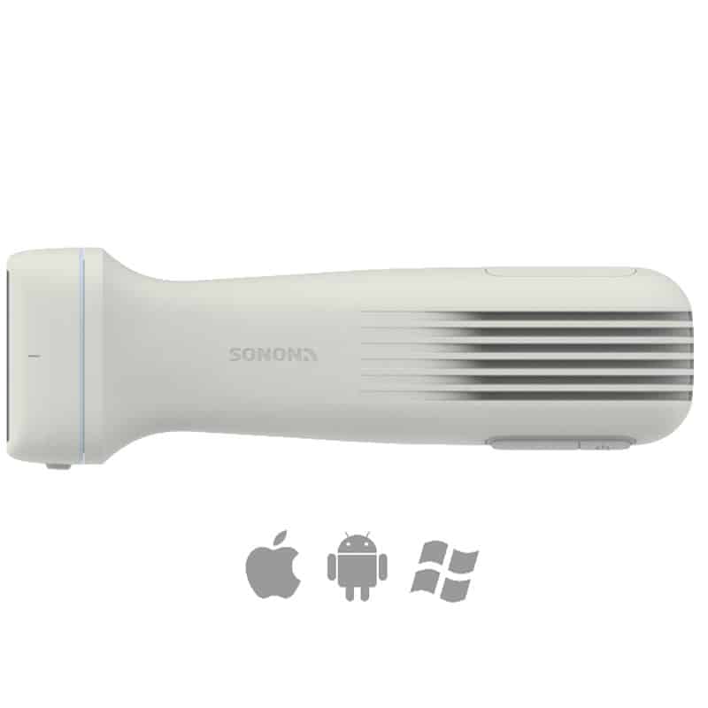 Sonon 500L Ultrasound